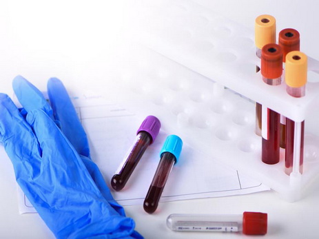Анализ крови поможет обнаружить сразу 13 форм рака