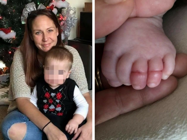 Младенец почти лишился пальцев ног из-за волос матери – ФОТО