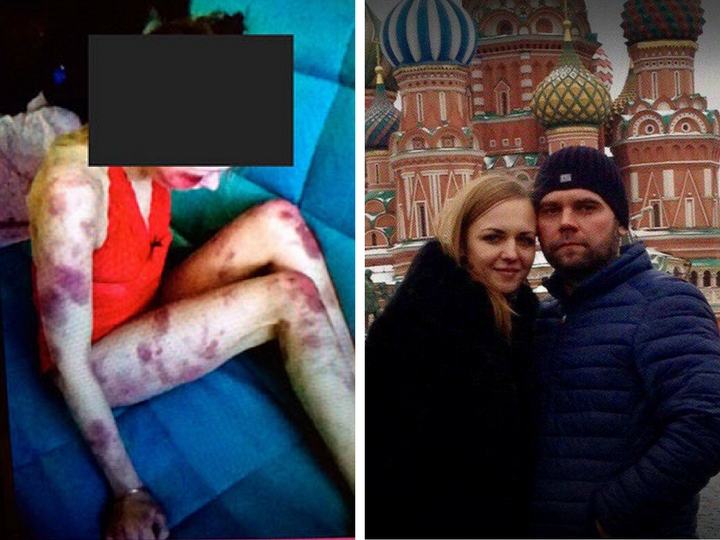 В России мужчина до смерти избил свою гражданскую жену и снял зверство на видео – ФОТО